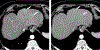 FIGURE 14.