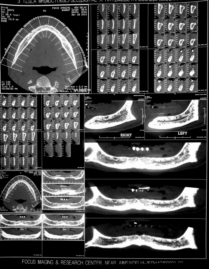 Fig. 1