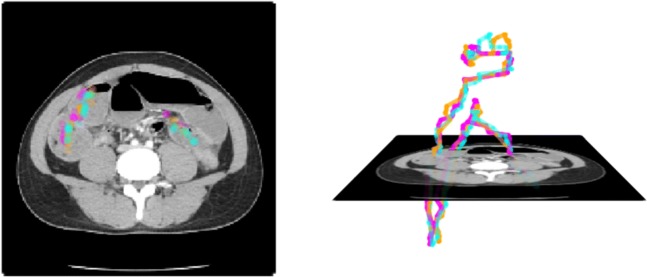 Fig. 2