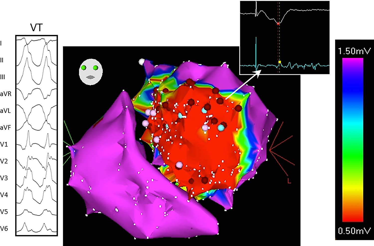 Figure 2: