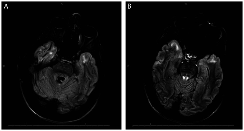 Figure 2-11.