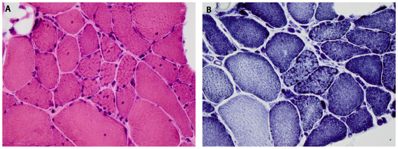 Figure 2-16.