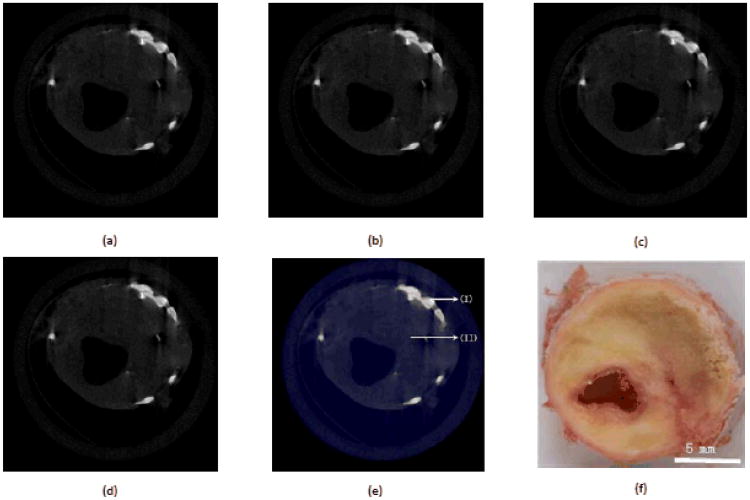 Fig.2