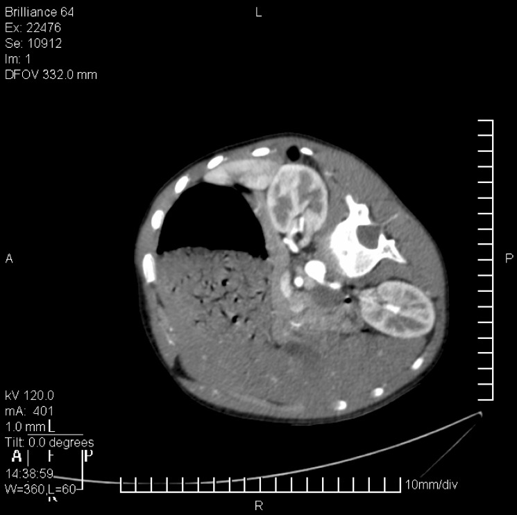 Fig. 3