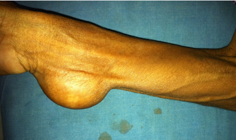 [Table/Fig-1]: