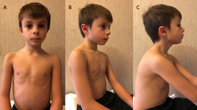 Fig. 1