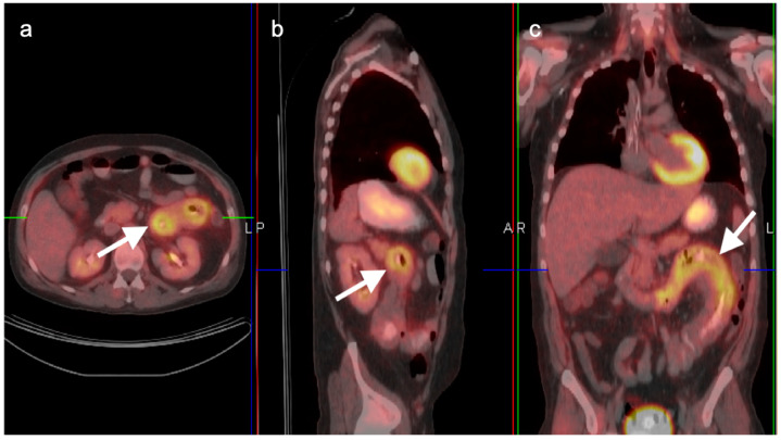 Figure 35