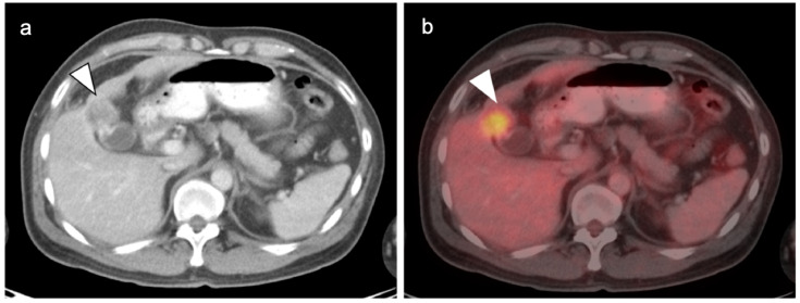 Figure 21