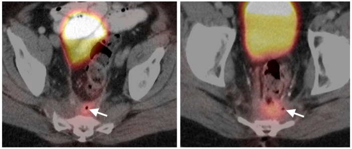 Figure 38