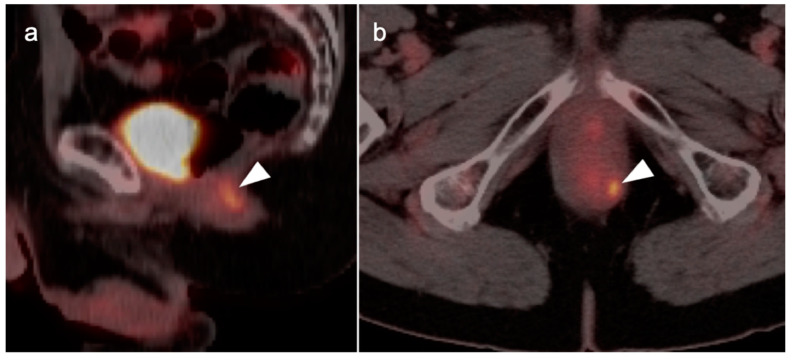 Figure 42