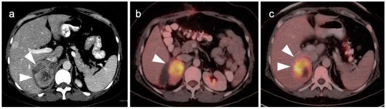 Figure 24