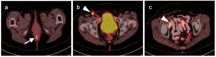 Figure 39