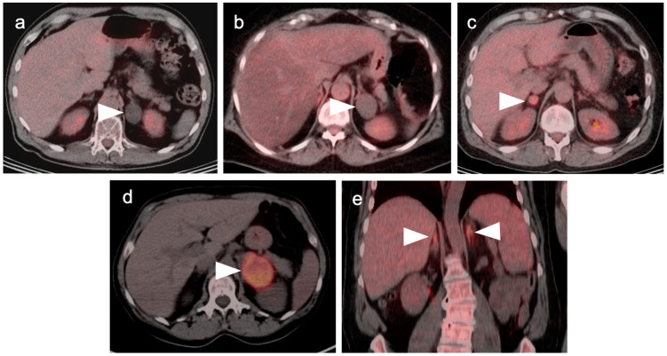 Figure 25