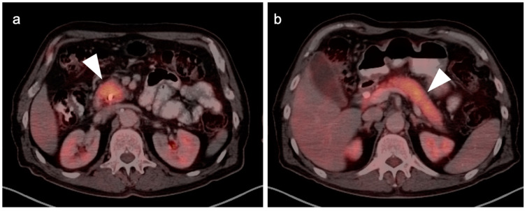 Figure 28