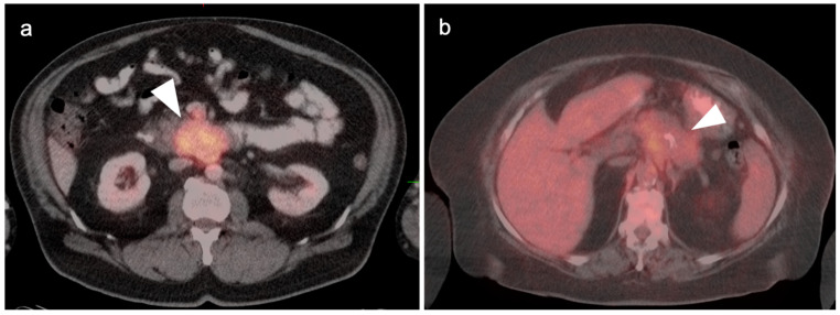 Figure 26