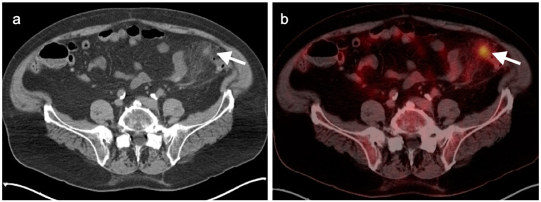 Figure 36