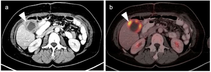 Figure 23