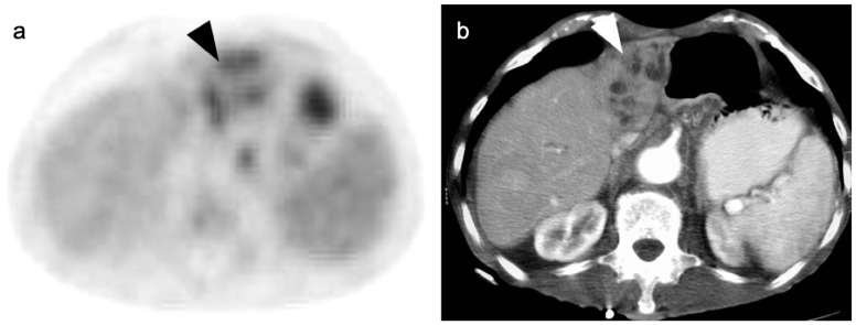 Figure 20