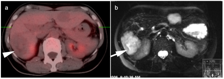 Figure 16