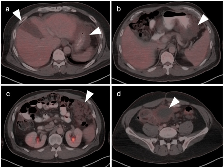 Figure 32