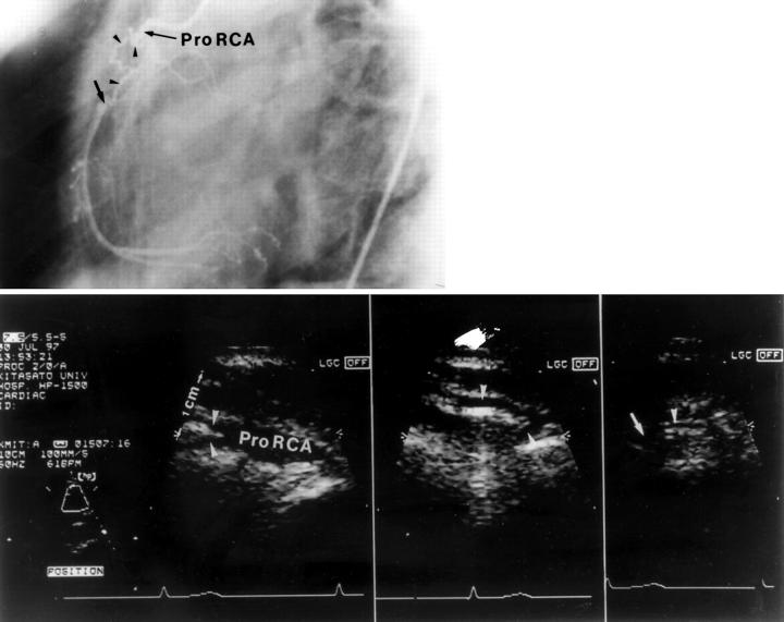 Figure 3  