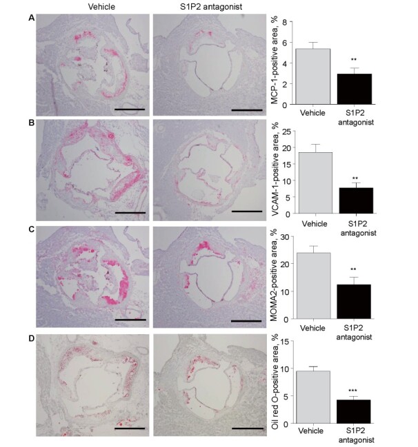 
Fig. 3.
Effect of S1P2 antagonist on characteristics of atherosclerotic plaques
