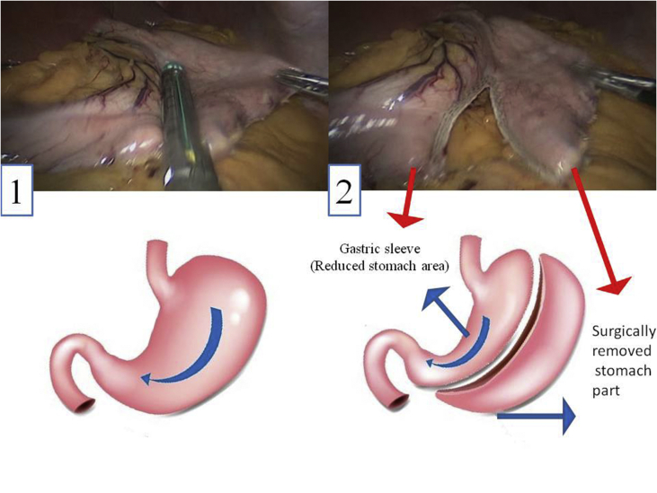 Figure 1