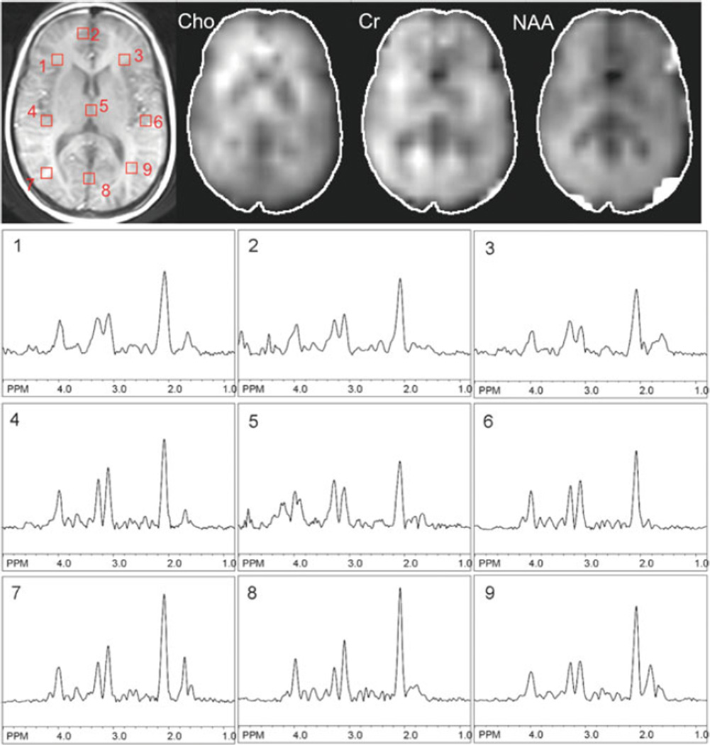 Fig. 9.6