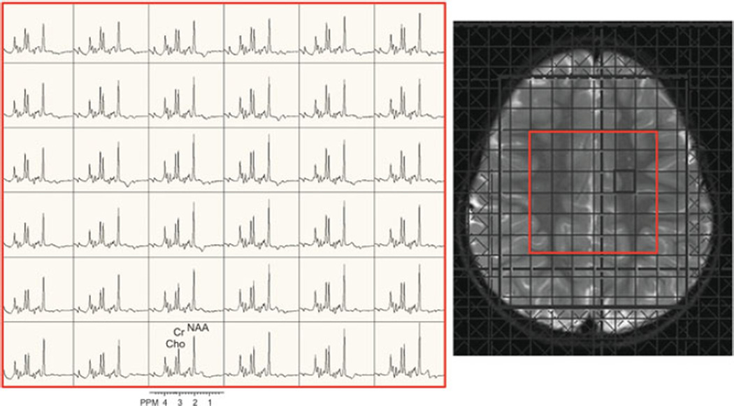 Fig. 9.4