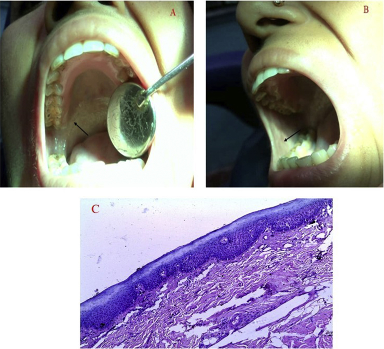 Fig. 1