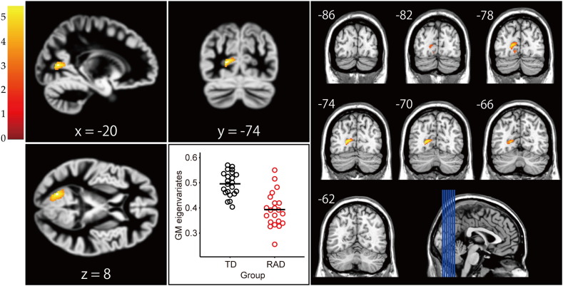 Fig. 1