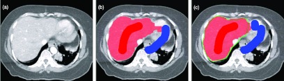 Figure 15