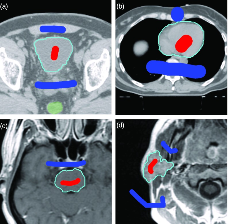 Figure 16