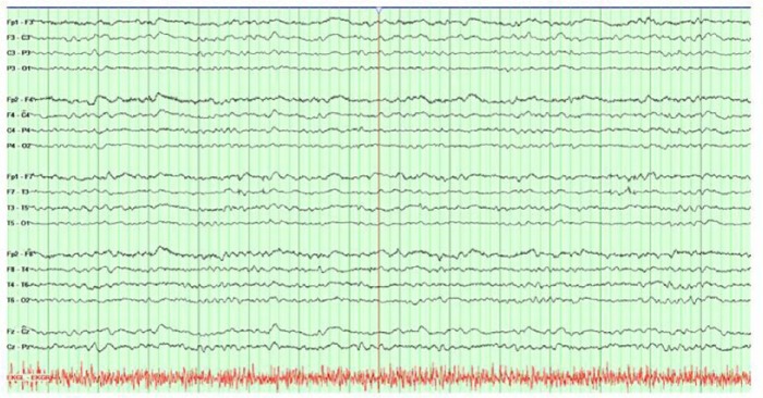 Figure 2.