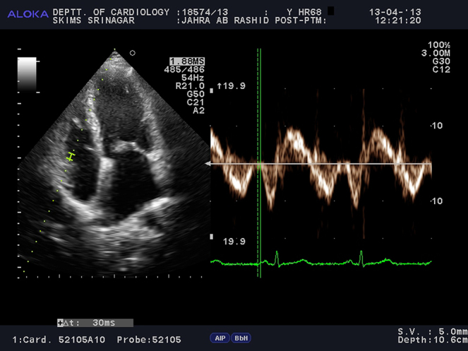 Fig. 3