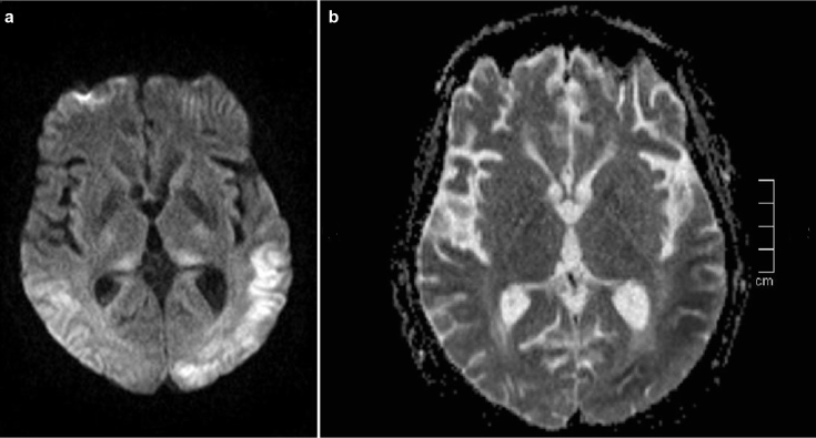 FIG. 2. a, b.