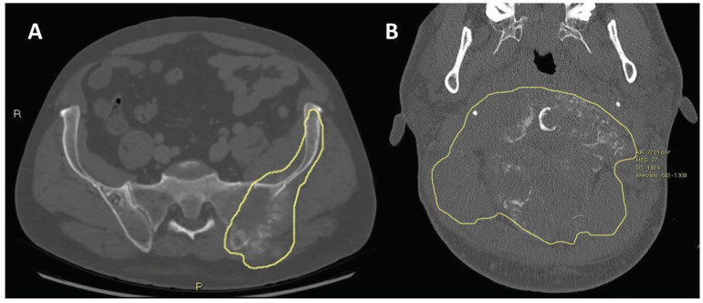 Figure 13