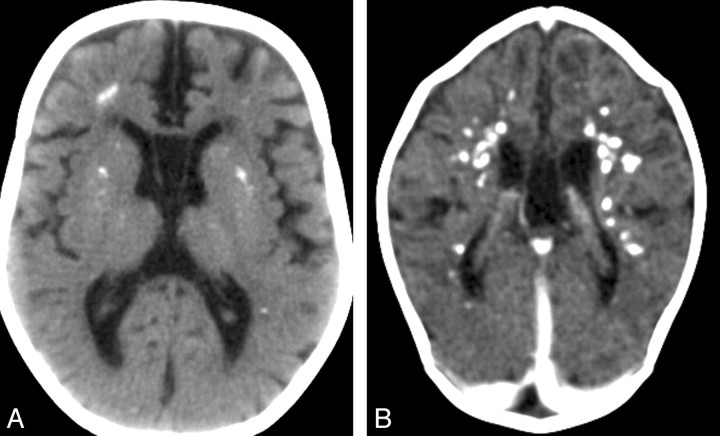 Fig 2.