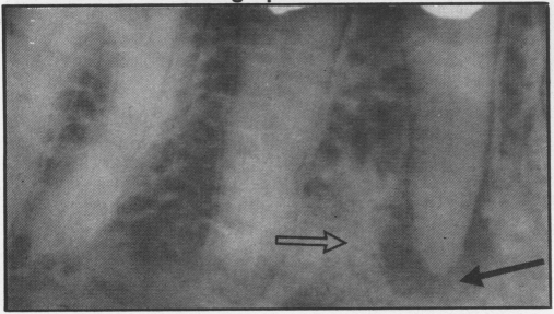 Figure 4b