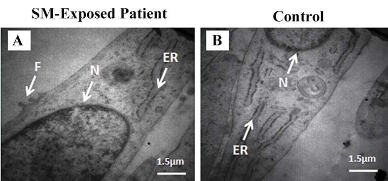 Fig 4