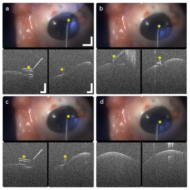 Fig. 11