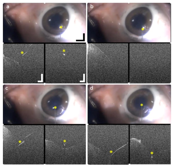 Fig. 13