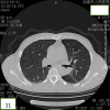 Fig. 11