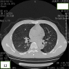 Fig. 12