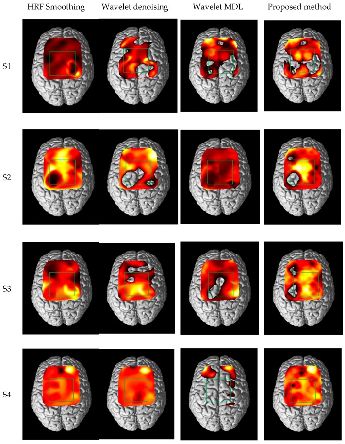 Figure 12