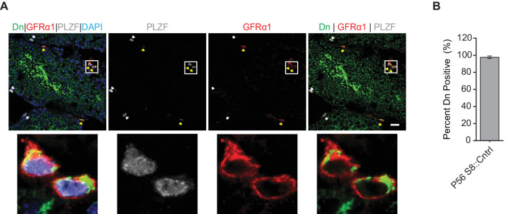 Figure 1—figure supplement 2.