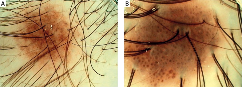 Figure 1 A, B