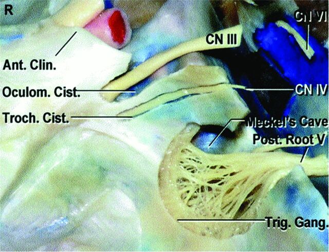 Fig 2.