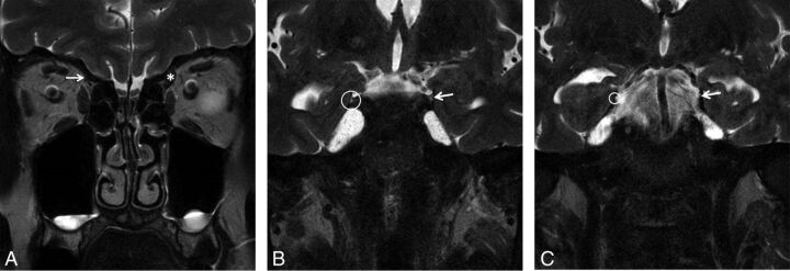 Fig 5.