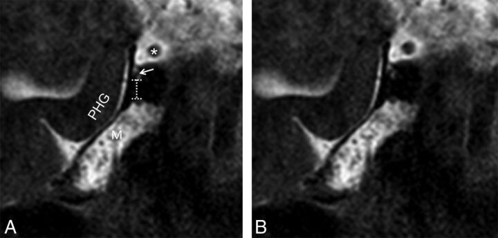 Fig 4.